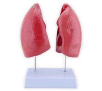 Modello di anatomia polmonare staccabile con 4 parti staccabili e...