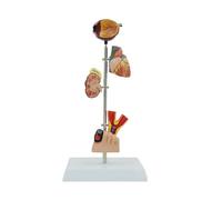 Modello di anatomia renale patologica per le malattie studio patologia umana modello dimostrativo insegnamento medico insegnamento