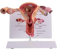 Modello di Atomia delle Organizzazioni Riproduttive Femminili, Modello Atomico Dell'utero D Dell'ovaio, Modello Atomico Dell'utero Patologico D Ovaio, Realistico A Grandezza Naturale