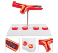 Modello di blocco vascolare - Simulazione del modello di flusso sanguigno