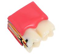 Modello di carie dentale: modello didattico per l'educazione dentale,