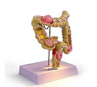 Modello di colon, modello di patologia del colon a grandezza naturale 1:1, modelli di studio anatomico dell'apparato digerente e dell'intestino crasso la formazione medica(Large)
