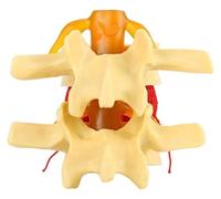 Modello di colonna lombare, modello didattico di vertebre lombari degenerative umane, for lo studio e la dimostrazione didattica degli studenti