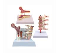 Modello di Colonna Vertebrale Umana Osteoporosi Modello Anatomico Set da 3 Pezzi in PVC per Studio Scientifico Educazione del Paziente