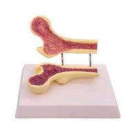 Modello di confronto for la salute e l'allentamento del femore in plastica PVC, modelli scheletrici accurati, modello anatomico for uso dimostrativo medico