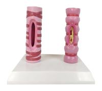Modello di contrasto della trachea umana, anatomia degli organi, struttura del sistema respiratorio, trachea umana sana e modello di confronto patologico - modello di confronto tra tubo polmonare