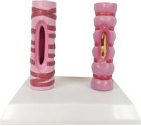 Modello di contrasto della trachea umana, anatomia degli organi, struttura del sistema respiratorio, trachea umana sana e modello di confronto patologico, trachea polmonare patologica