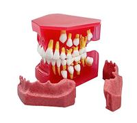 Modello di dente deciduo per bambini, modello di dente sostitutivo 1:1, modello orale Dente permanente deciduo Modello di visualizzazione alternativo Modello dentale