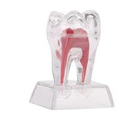 Modello di dente in plastica dura per la comunicazione e l'insegnamento | Modello di dente in plastica dura per una migliore comunicazione medico-paziente e istruzione dentale