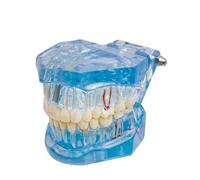 Modello Di Dente Umano - Modello Di Sezione Trasversale Dei Denti In Resina Per Simulazione Realistica, Adatto Per Apprendimento E Insegnamento In Aula Scientifica