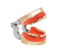 Modello di denti affetti da malattia parodontale, dimostrazione didattica odontoiatrica, modello di educazione patologica per il paziente