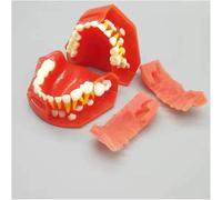 Modello di Denti Decidui Dentali, Modello alternato di denti decidui e permanenti per bambini - Modello dimostrativo dei denti - per l'insegnamento dello studio, dai 3 ai 12 anni (Color : 3 to 6 year