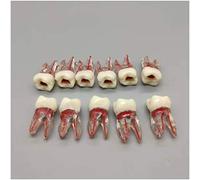 Modello di Denti, Modello - 11 Pezzi Modello di Pratica della radice - Modello di Simulazione del Dente Orale - Modello di Anatomia del Canale radicolare -,