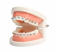 Modello di denti ortodontici dentali con apparecchi bocca for protesi for odontoiatria