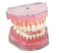 Modello di denti Typodont con denti rimovibili Modello didattico per studio dentale per studenti che imparano l'anatomia dei Dimostrazione della bocca per la formazione educativa dentale