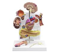 Modello di Diabete di Anatomia, Modello Educativo Diabete, Modello di Organo Del Diabete Set di 8 Parti, Modello di Patologia Del Diabete Materiale In PVC per La Ricerca Medica