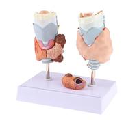 Modello di dissezione normale e patologica della tiroide umana ingrandita con base per studio anatomico 17,5x12,5x18,0 cm
