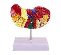Modello di fegato umano - Visualizzazione anatomica del modello del fegato di patologia, organo medico | Display educativo visivo luminoso del fegato per studenti, insegnanti, apprendimento anatomico