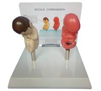 Modello di feto - Feto fumante e Modello di confronto del feto Normale - Modelli scientifici di Anatomia Umana in Materiale PVC - per la visualizzazione dello Studio Modello Medico didattico