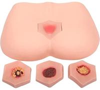 Modello di formazione dell'ulcera da decubito - 4 fasi di piaghe da decubito per l'educazione alla cura delle ferite nelle scuole e nell'apprendimento a casa