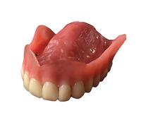 Modello di impianti superiori dentali, modello di denti superiori sovrastante, modello di protesi dentarie demo visione trasparente per strumento di modello di istruzione e studio
