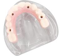 Modello di impianto dentale con protesi a ponte, modello di denti dentali, studio dei denti adulti Modelli Typodont for l'insegnamento degli impianti di malattie patologiche dentali