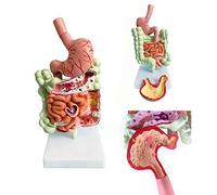 Modello di malattia del colon umano, modello di anatomia gastrointestinale umana, modello dell'apparato digerente umano, struttura degli organi interni degli esseri umani, modello anatomico gastrointe