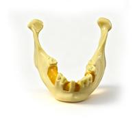 Modello di mandibola dentale per la pratica di perforazione e inserimento di impianti, mandibola liscia per la pratica di perforazione, ottimo dente per la formazione odontoiatrica