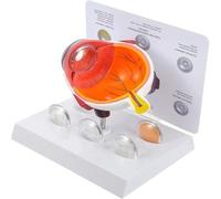 Modello di occhio con cataratta, modello di anatomia dell'occhio, educazione alla fisiologia, modello di anatomia for studi medici e aule, risorse di apprendimento medico