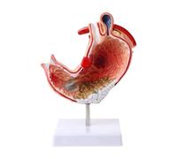 Modello di organo umano, modello di anatomia addominale, modello di anatomia patologica, modello di anatomia dello stomaco for la ricerca medica, strumento didattico