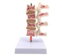 Modello di organo umano, modello patologico della colonna lombare, modello anatomico delle ossa della gamba umana, esemplare di colonna vertebrale tagliato for studenti di medicina(C)