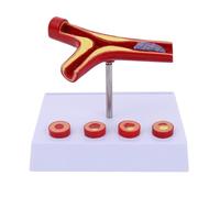 Modello di organo umano, modello vascolare umano, ingrandimento 10X, modello di patologia vascolare, modello di anatomia dell'aterosclerosi for esposizione e studio a scuola