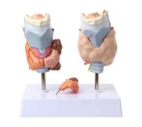 Modello di patologia anatomica della tiroide umana medica Patologia normale e patologica Strumento di risorse per l'insegnamento medico Struttura Anatomia Strumento di apprendimento per l'insegnamento
