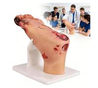 Modello Di Patologia Dell'ulcera Del Piede Diabetico, Design Dall'aspetto Realistico E Altamente Simulato, Simulatore Infermieristico Con Lesioni Purulente(Mild Disease)