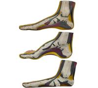 Modello di Piede 3 Pezzi, Modello anatomico del Piede 1:1 con Arco Normale Piatto e arcuato, con Struttura di Ossa, Muscoli e legamenti, per Esposizione e insegnamento scientifico