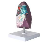 Modello di polmone fumante, Modello anatomico di polmone Umano 2:3 con Caratteristiche patologiche per Modelli didattici Comunicazione Medico-paziente