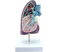 Modello di polmone umano patologico Modello di medicina interna Modello polmonare Anatomia polmonare Modello del sistema respiratorio Modello anatomico del polmone umano - Tubercolosi patologica