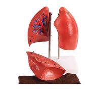 Modello di polmone umano sano, 4 parti staccabili, strumento didattico for modello anatomico del polmone umano, for studi medici e aule.