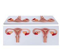 Modello di Processo di Fecondazione Anatomica, Modello di Processo di Fecondazione Umana, Modelli di Sezioni degli Organi Riproduttivi Femminili Dell'utero, Ovari