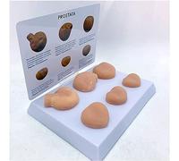 Modello di prostata, modello anatomico riproduttivo maschile per studio, display per lesioni alla prostata, modello educativo di anatomia adulta per l'apprendimento della salute e della biologia