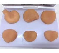 Modello di Prostata Umana, Modello di Cancro alla Prostata, Modello di Struttura Anatomica della Massa Prostatica, Anatomia Umana, Modello di Organo Umano per Studio E Insegnamento Medico.