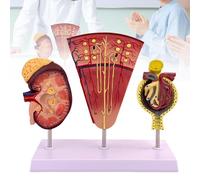 Modello di rene, modello di nefrone e glomerulo renale umano, modello anatomico del rene per l'insegnamento medico, adatto alla dissezione assistita