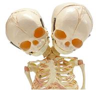 Modello di scheletro umano per bambini, teschio fetale con due teste, modello 1: 1 con display anatomico umano fetale