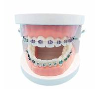 Modello di simulazione del dente orale - Modello dimostrativo ortodontico dentale - Modello di trattamento dentale dei denti con staffa in metallo, modello di spiegazione del filo dell'arco con