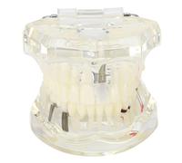 Modello di studio per impianti dentali, strumento trasparente per la visualizzazione della struttura dei denti per dimostrazioni didattiche e