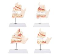 Modello di sviluppo dei denti in evoluzione per conferenze ed esposizioni | Processo dettagliato di crescita dei denti con lo strato smaltato della dentina e della polpa per l'educazione alla salute
