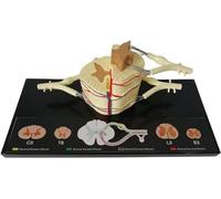 Modello Di Transezione Della Vertebra Cervicale, Modello Anatomico | Anatomia Dell'ingrandimento Del Nervo Spinale, Mola Del Midollo Spinale Parziale Vertebrale, For L'insegnamento Medico