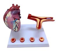 Modello di trombosi con occlusione delle arterie e dei vasi sanguigni Modello cuore umano Modelli didattici Modelli scientifici per l'insegnamento in classe e lo studio della cardiologia