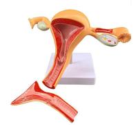 Modello di Utero E Ovaie, Modello di Organo Riproduttivo Femminile, Modello Anatomico di Utero Umano con Design Rimovibile, a Grandezza Naturale per Dimostrazione Didattica Scolastica