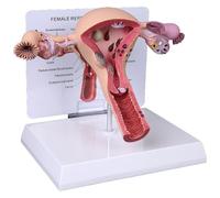 Modello di utero e ovaio